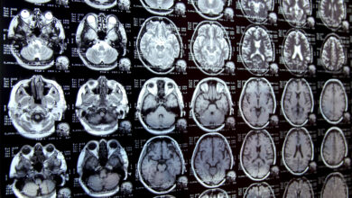 new-ai-system-could-accelerate-clinical-research