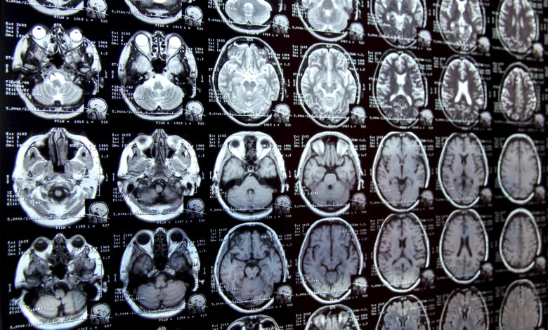 new-ai-system-could-accelerate-clinical-research